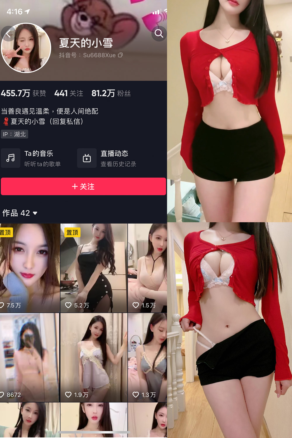 抖音 夏天的小雪 微密圈 NO.006期 【3V】