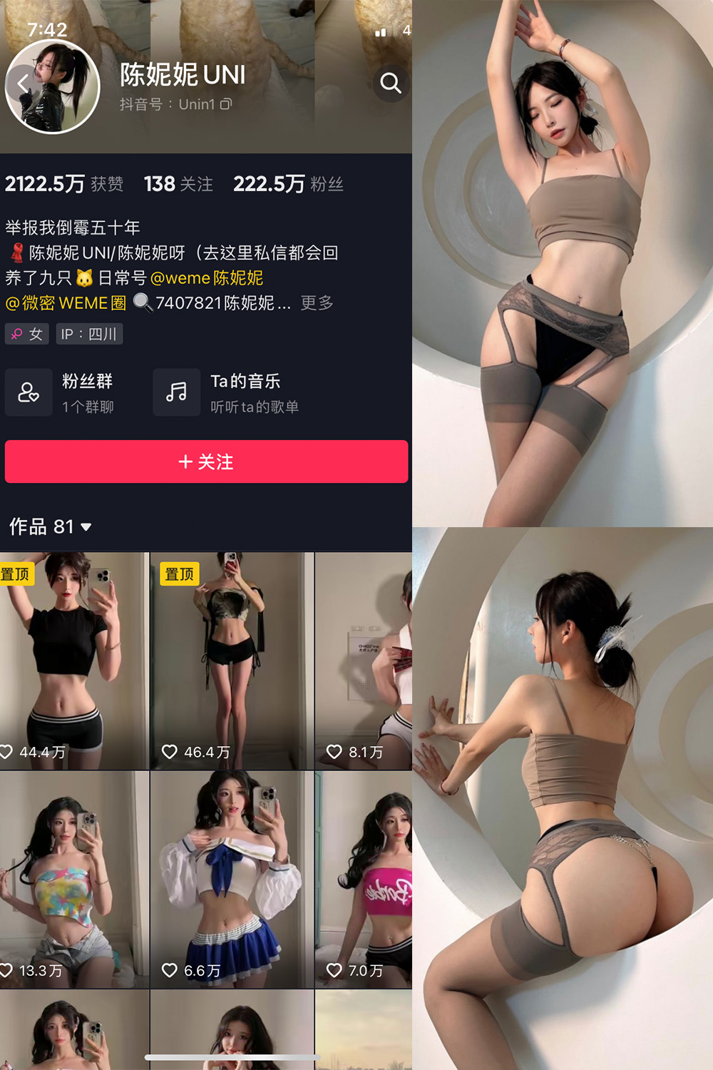 抖音 陈妮腻UNI 微密圈 NO.037期 【22P】