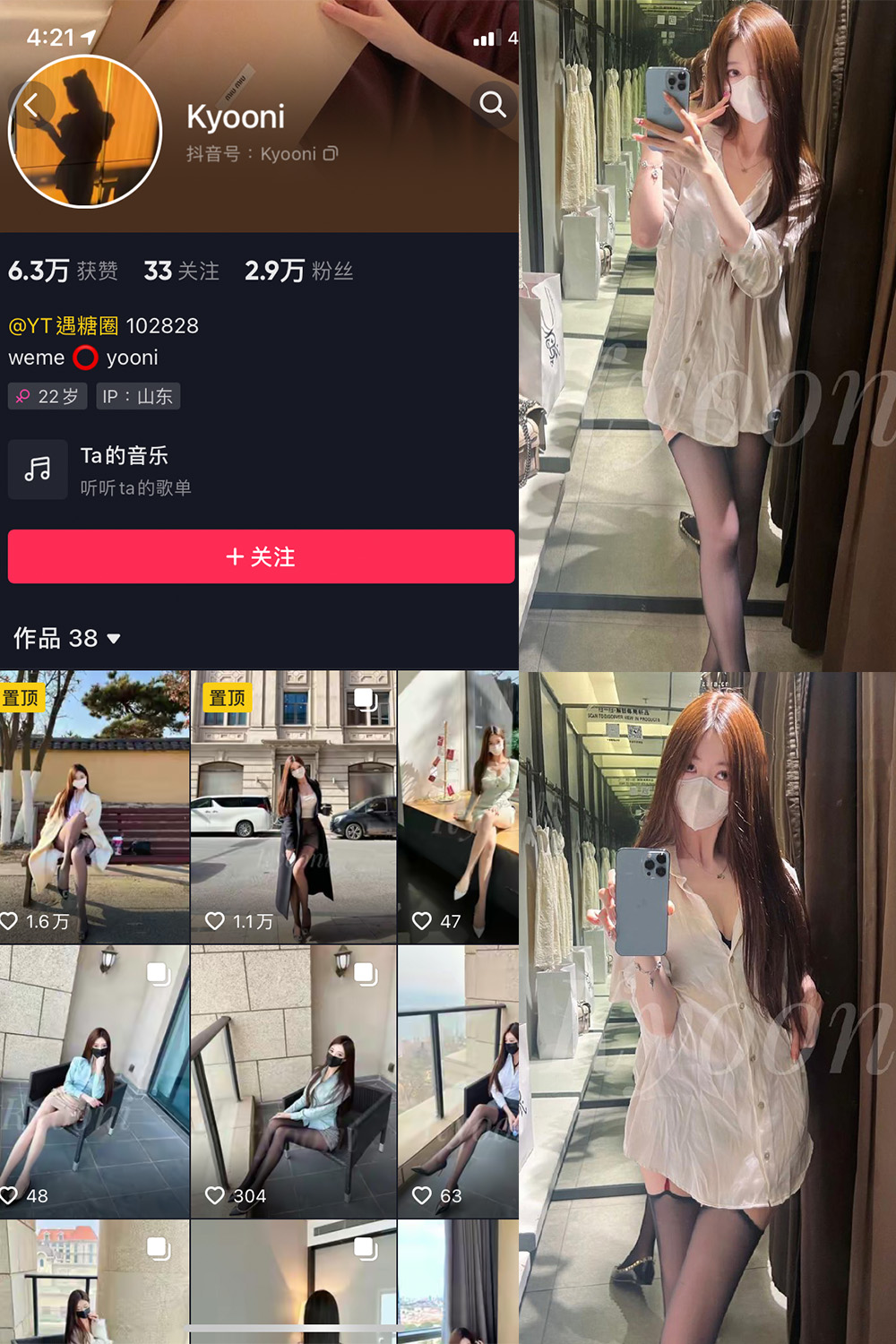 抖音 Yooni有你喵 微密圈 NO.016期 【11P】