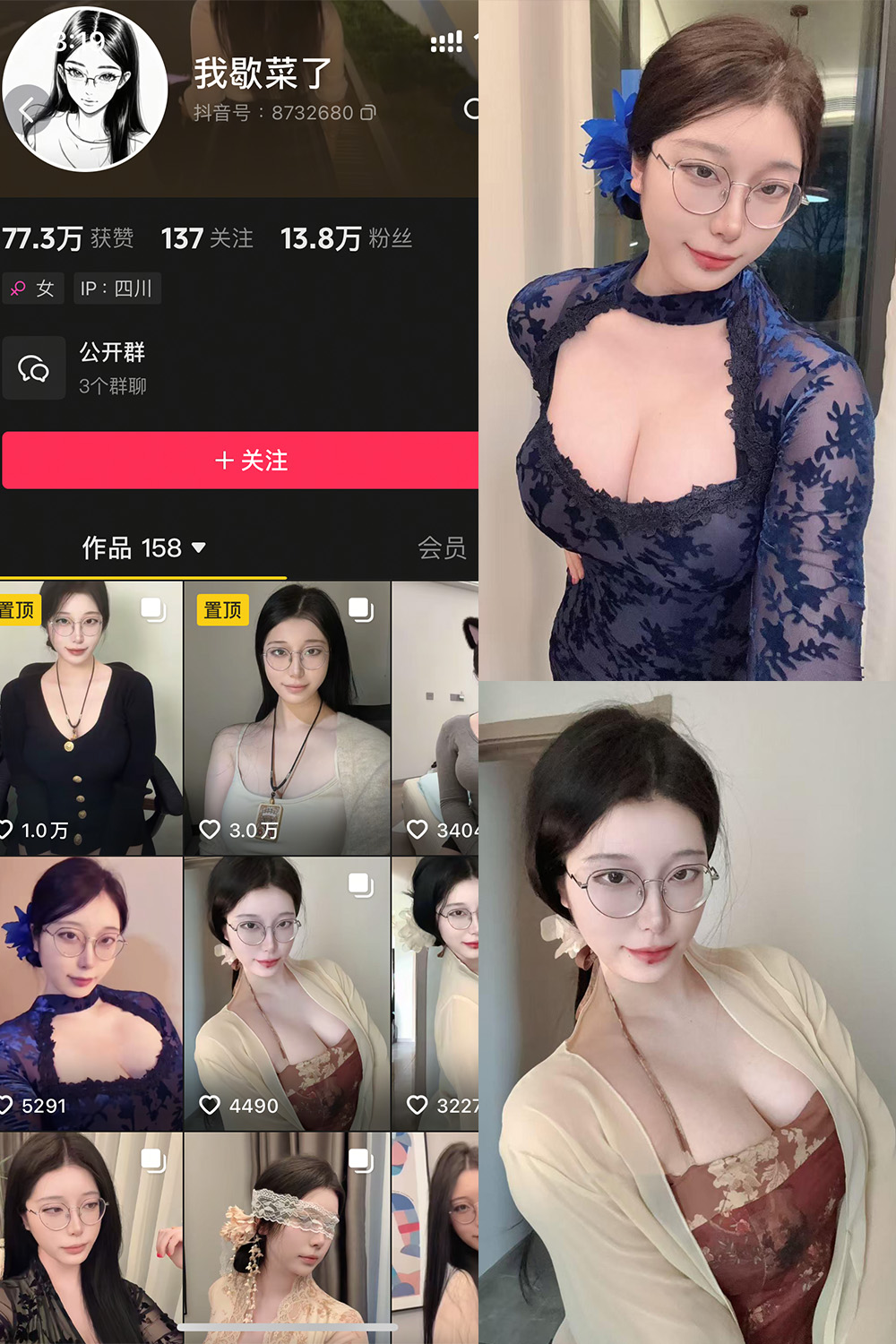 抖音 我歇菜了 微密圈 NO.001期 【10P】