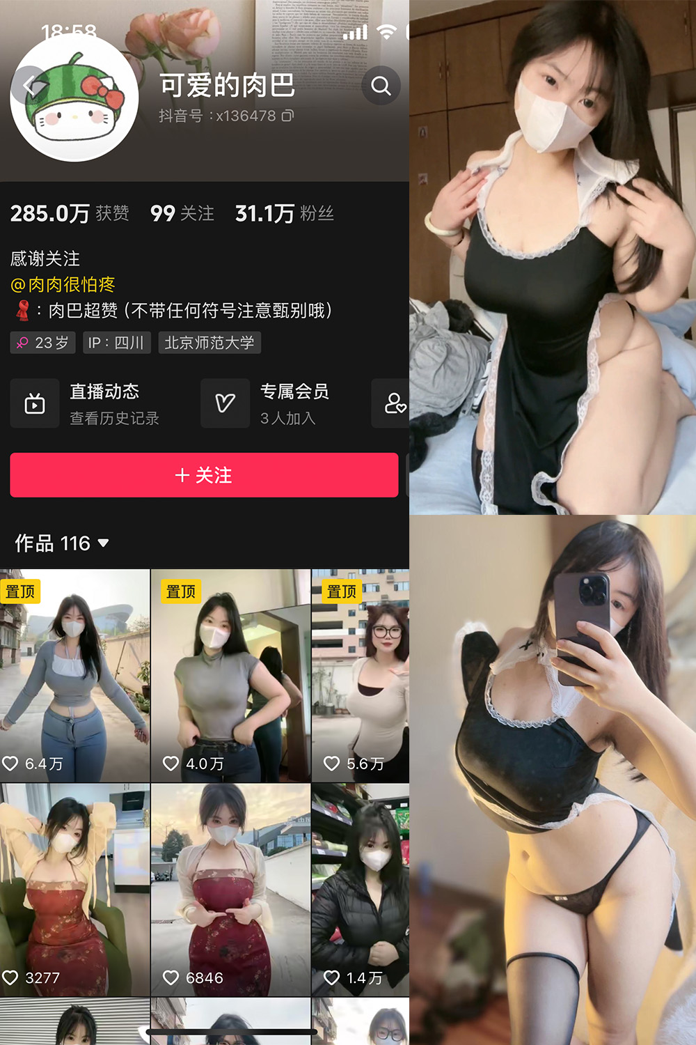 抖音 可爱的肉巴 微密圈 NO.005期 【14P12V】