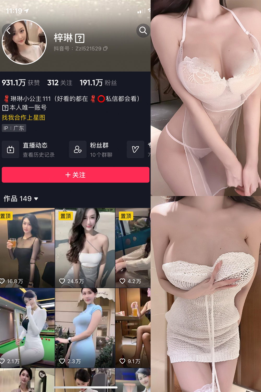 抖音 琳琳小公主 微密圈 002 期 【31P1V】