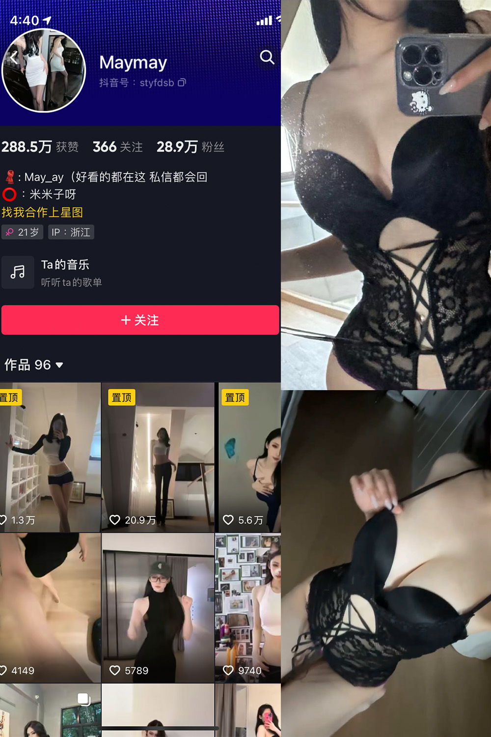 抖音 米米子呀 微密圈 NO.005期 【1P2V】