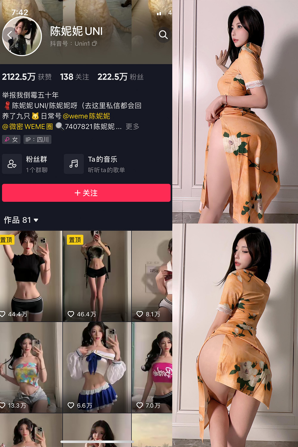 抖音 陈妮腻UNI 微密圈 NO.061期 【11P】